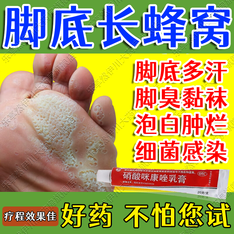 脚心痒是什么寓意_脚心痒是吉是凶_脚心痒是怎么回事